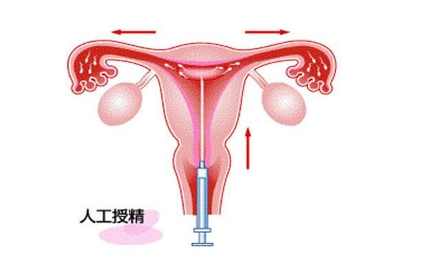 女孩终身不孕