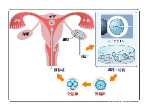 人流