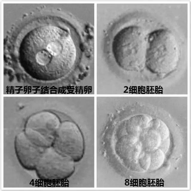 人流手术