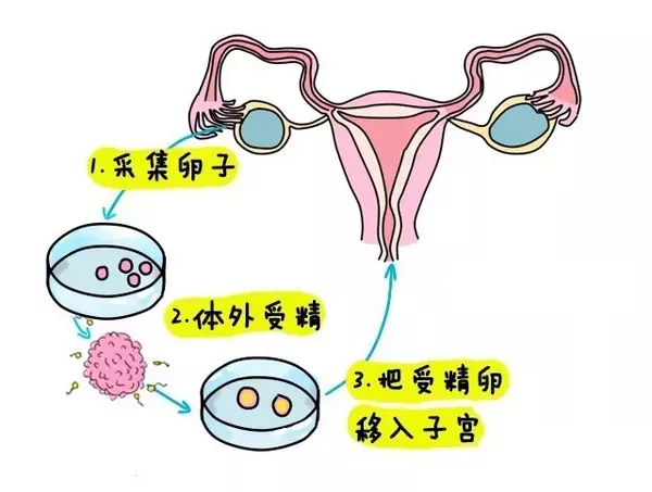 女孩终身不孕