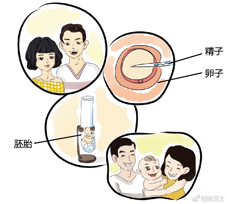 人流手术