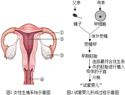 做人流手术