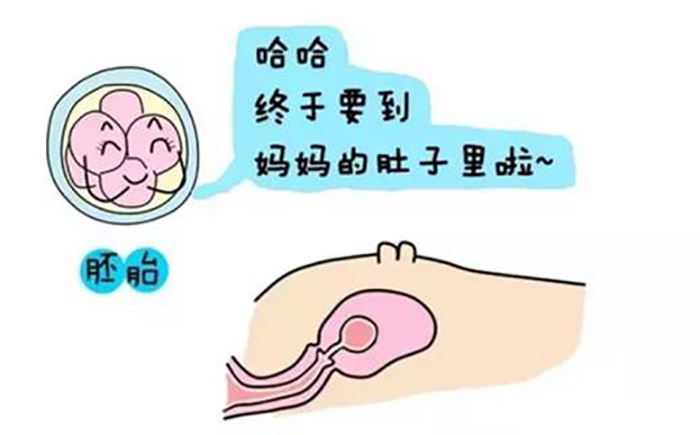 人流手术