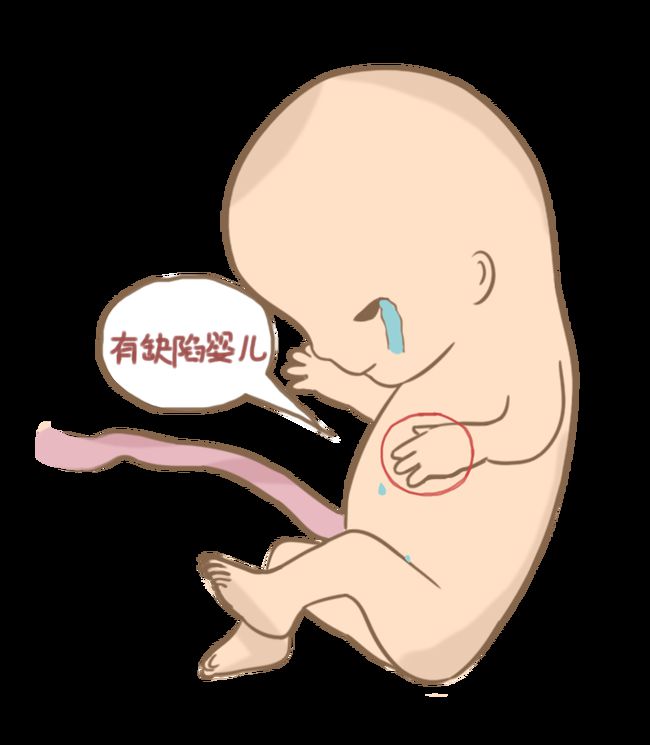 新生儿