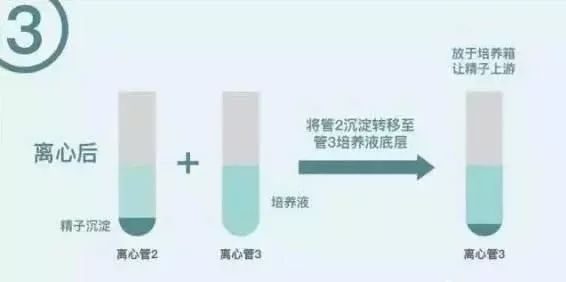 怀孕