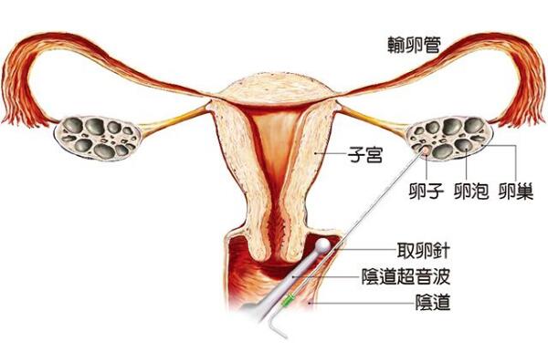 早孕