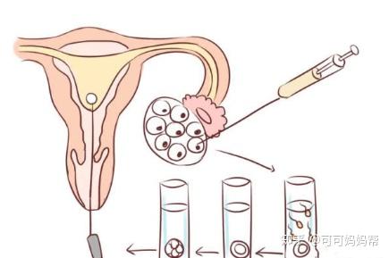 女性什么体质最难怀孕