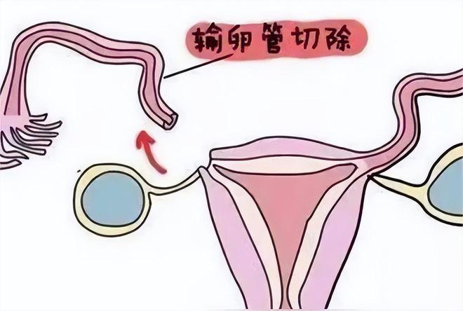 早孕试纸