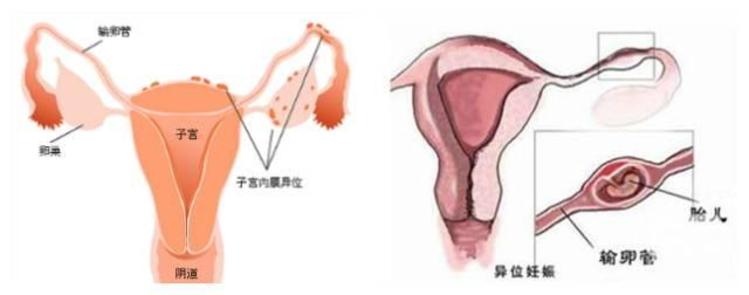 上海试管婴儿