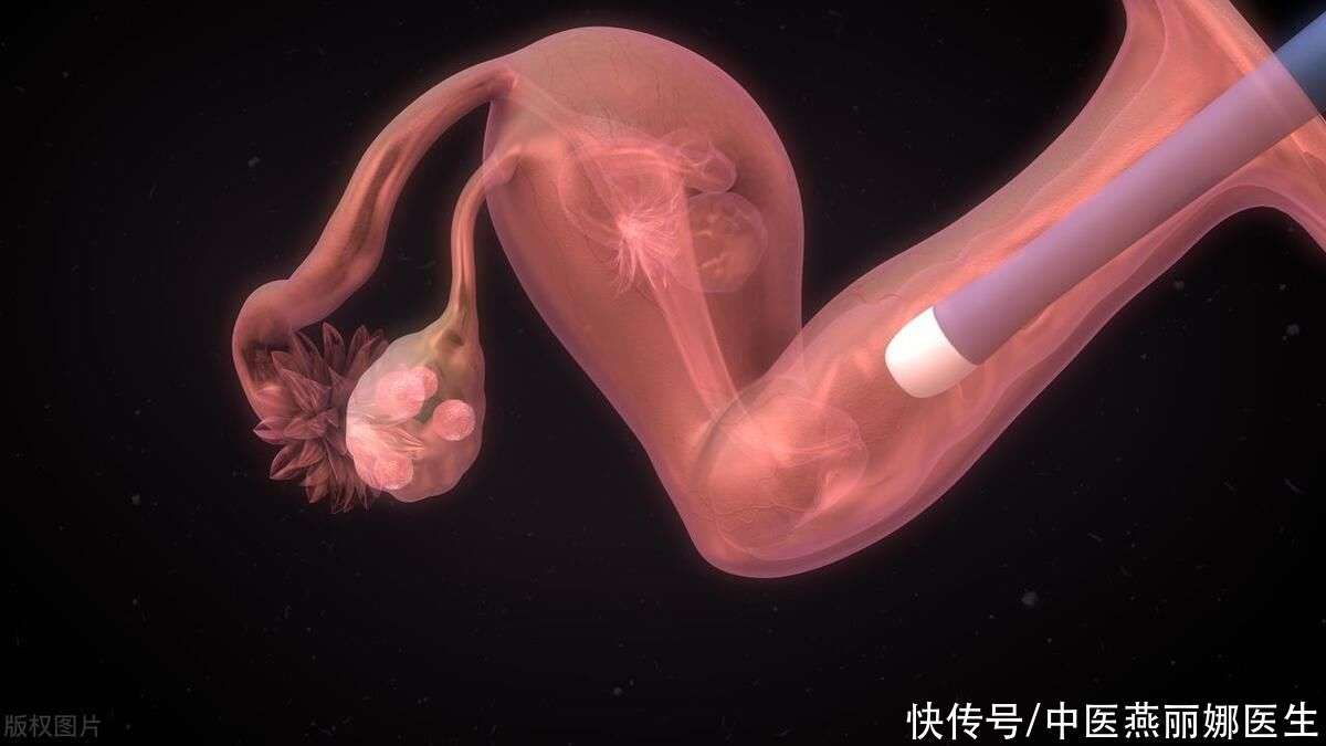 卵巢早衰