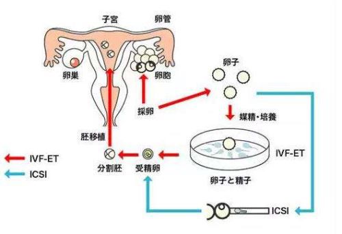 卵巢早衰捐卵价格