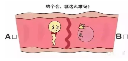 卵巢早衰