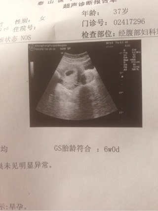 北京卵巢早衰
